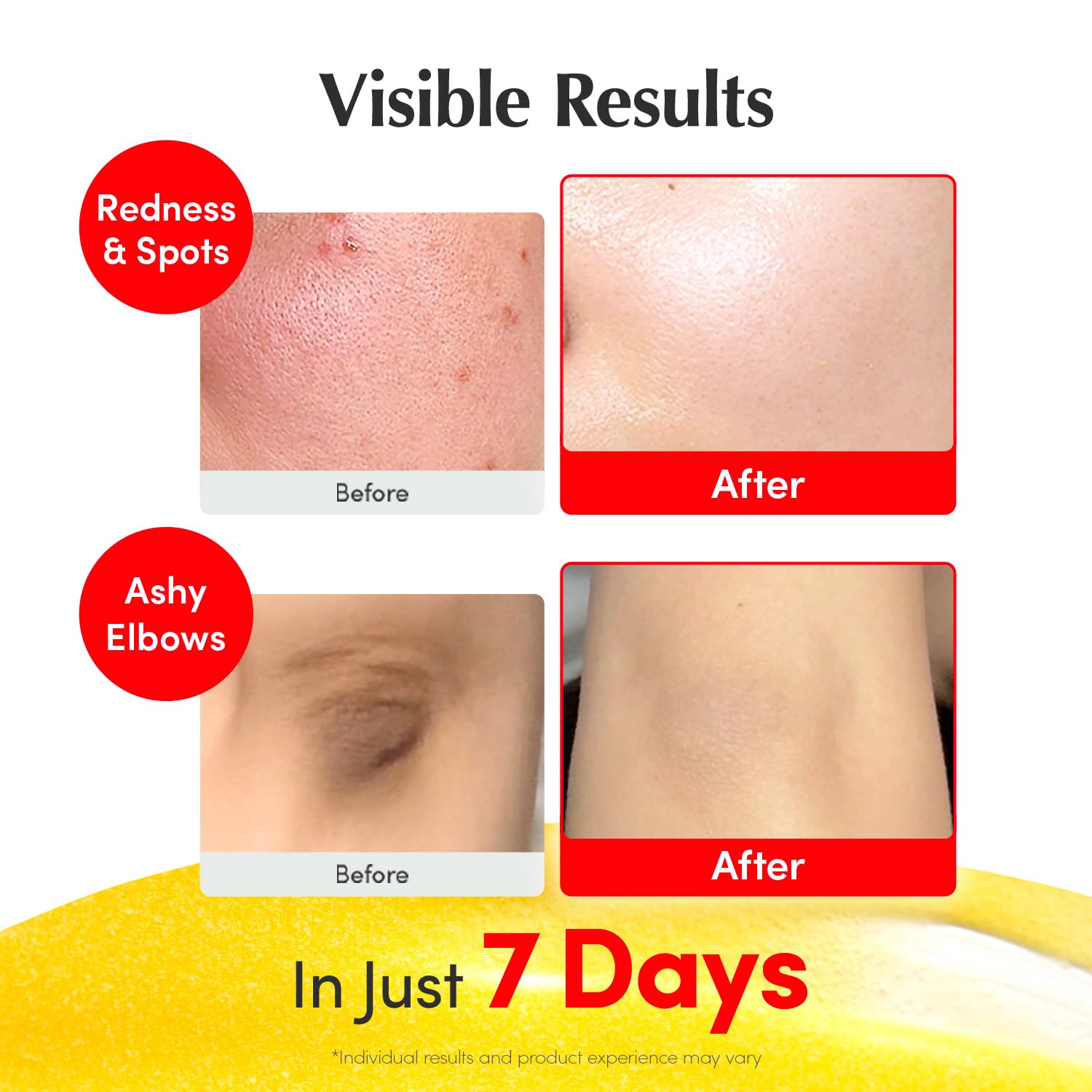 Vitamin Illuminating Serum – Niacinamide 4% + Brightening Vitamin C Face Serum with Hyaluronic Acid & Vitamin E – Dark Spot & Uneven Tone Care – Korean Skincare – 1.01 fl.oz - Image 4